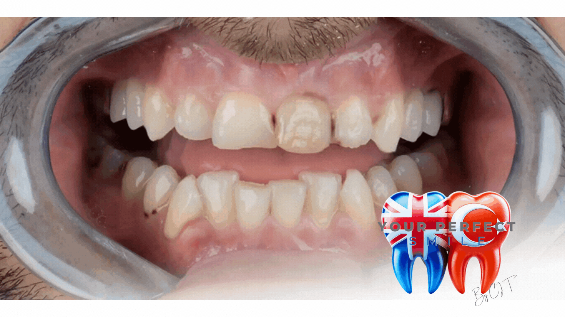 Comprehensive Dental Treatment Packages