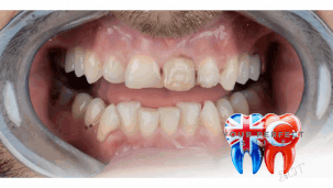 Comprehensive Dental Treatment Packages